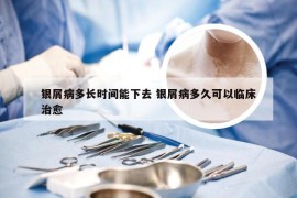 银屑病多长时间能下去 银屑病多久可以临床治愈