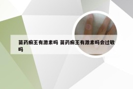 苗药癣王有激素吗 苗药癣王有激素吗会过敏吗