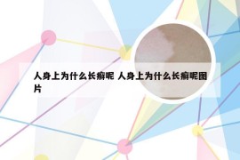 人身上为什么长癣呢 人身上为什么长癣呢图片