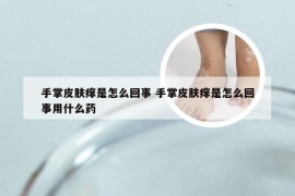 手掌皮肤痒是怎么回事 手掌皮肤痒是怎么回事用什么药