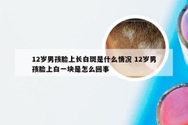 12岁男孩脸上长白斑是什么情况 12岁男孩脸上白一块是怎么回事