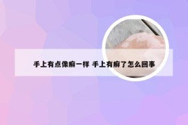 手上有点像癣一样 手上有癣了怎么回事