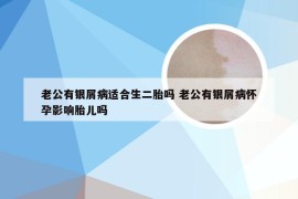 老公有银屑病适合生二胎吗 老公有银屑病怀孕影响胎儿吗