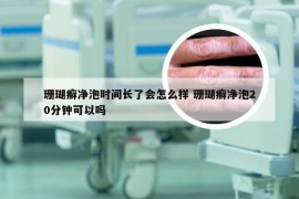 珊瑚癣净泡时间长了会怎么样 珊瑚癣净泡20分钟可以吗