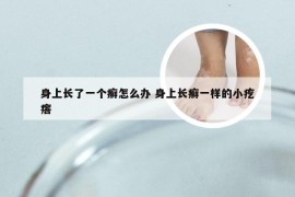 身上长了一个癣怎么办 身上长癣一样的小疙瘩