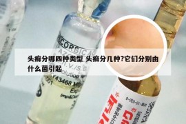 头癣分哪四种类型 头癣分几种?它们分别由什么菌引起