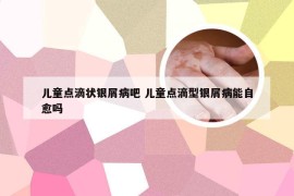 儿童点滴状银屑病吧 儿童点滴型银屑病能自愈吗