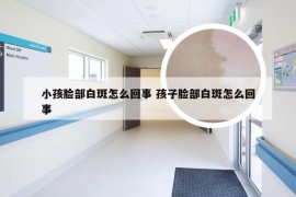 小孩脸部白斑怎么回事 孩子脸部白斑怎么回事