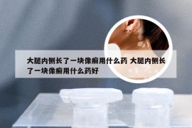 大腿内侧长了一块像癣用什么药 大腿内侧长了一块像癣用什么药好