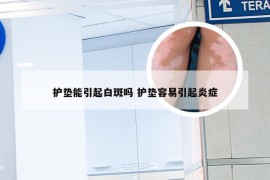 护垫能引起白斑吗 护垫容易引起炎症