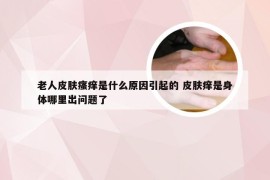 老人皮肤瘙痒是什么原因引起的 皮肤痒是身体哪里出问题了