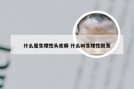 什么是生理性头皮癣 什么叫生理性脱发