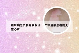 银屑病怎么和男朋友说 一个银屑病患者的无奈心声