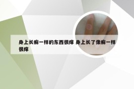 身上长癣一样的东西很痒 身上长了像癣一样很痒