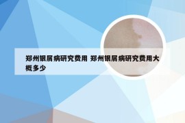 郑州银屑病研究费用 郑州银屑病研究费用大概多少