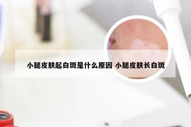 小腿皮肤起白斑是什么原因 小腿皮肤长白斑