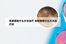 皮肤病有什么方法治疗 皮肤病有什么方法治疗好