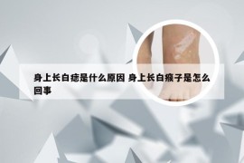 身上长白痣是什么原因 身上长白瘊子是怎么回事