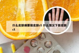 什么皮肤病要做皮肤ct 什么情况下做皮肤ct