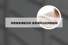 阿胶银屑病能吃吗 银屑病可以吃阿胶糕吗