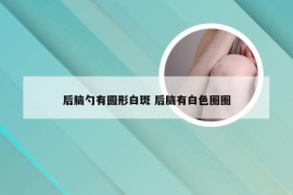 后脑勺有圆形白斑 后脑有白色圈圈