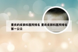 重庆的皮肤科医院排名 重庆皮肤科医院排名第一公立
