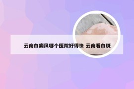 云南白癜风哪个医院好得快 云南看白斑