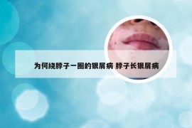 为何绕脖子一圈的银屑病 脖子长银屑病