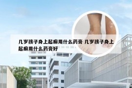 几岁孩子身上起癣用什么药膏 几岁孩子身上起癣用什么药膏好