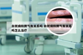 白斑病和脾气有关系吗 白斑病和脾气有关系吗怎么治疗