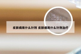 皮肤病用什么针剂 皮肤病用什么针剂治疗