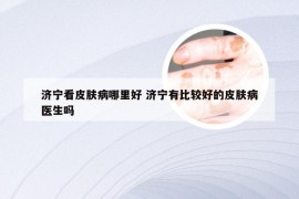 济宁看皮肤病哪里好 济宁有比较好的皮肤病医生吗