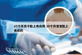 25个月孩子脸上有白斑 28个月宝宝脸上有白的