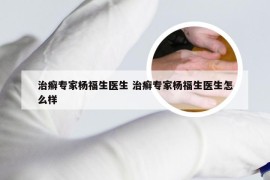 治癣专家杨福生医生 治癣专家杨福生医生怎么样