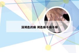 深褐色的癣 褐色癣不痛不痒