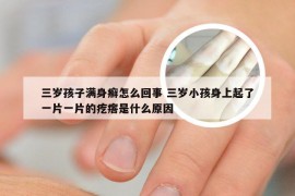 三岁孩子满身癣怎么回事 三岁小孩身上起了一片一片的疙瘩是什么原因