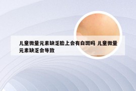 儿童微量元素缺乏脸上会有白斑吗 儿童微量元素缺乏会导致