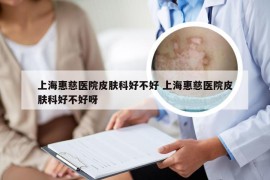 上海惠慈医院皮肤科好不好 上海惠慈医院皮肤科好不好呀