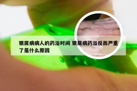 银屑病病人的药浴时间 银屑病药浴反而严重了是什么原因