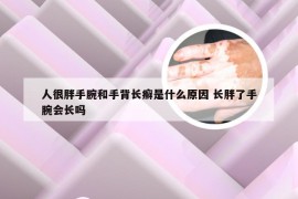 人很胖手腕和手背长癣是什么原因 长胖了手腕会长吗