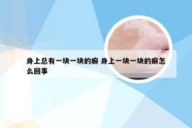 身上总有一块一块的癣 身上一块一块的癣怎么回事