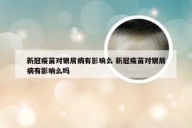 新冠疫苗对银屑病有影响么 新冠疫苗对银屑病有影响么吗