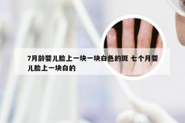 7月龄婴儿脸上一块一块白色的斑 七个月婴儿脸上一块白的