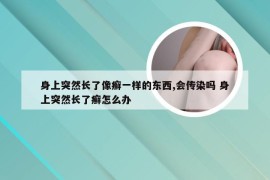 身上突然长了像癣一样的东西,会传染吗 身上突然长了癣怎么办