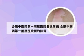 合肥中医院第一附属医院看银屑病 合肥中医药第一附属医院预约挂号