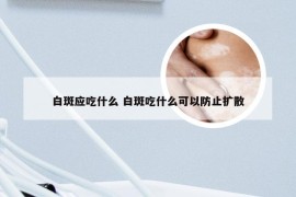 白斑应吃什么 白斑吃什么可以防止扩散