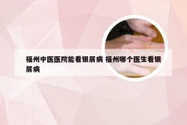 福州中医医院能看银屑病 福州哪个医生看银屑病