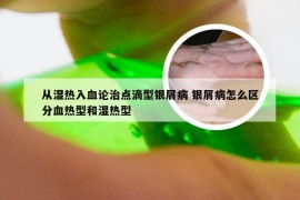 从湿热入血论治点滴型银屑病 银屑病怎么区分血热型和湿热型