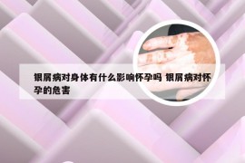 银屑病对身体有什么影响怀孕吗 银屑病对怀孕的危害