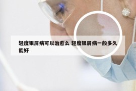 轻度银屑病可以治愈么 轻度银屑病一般多久能好